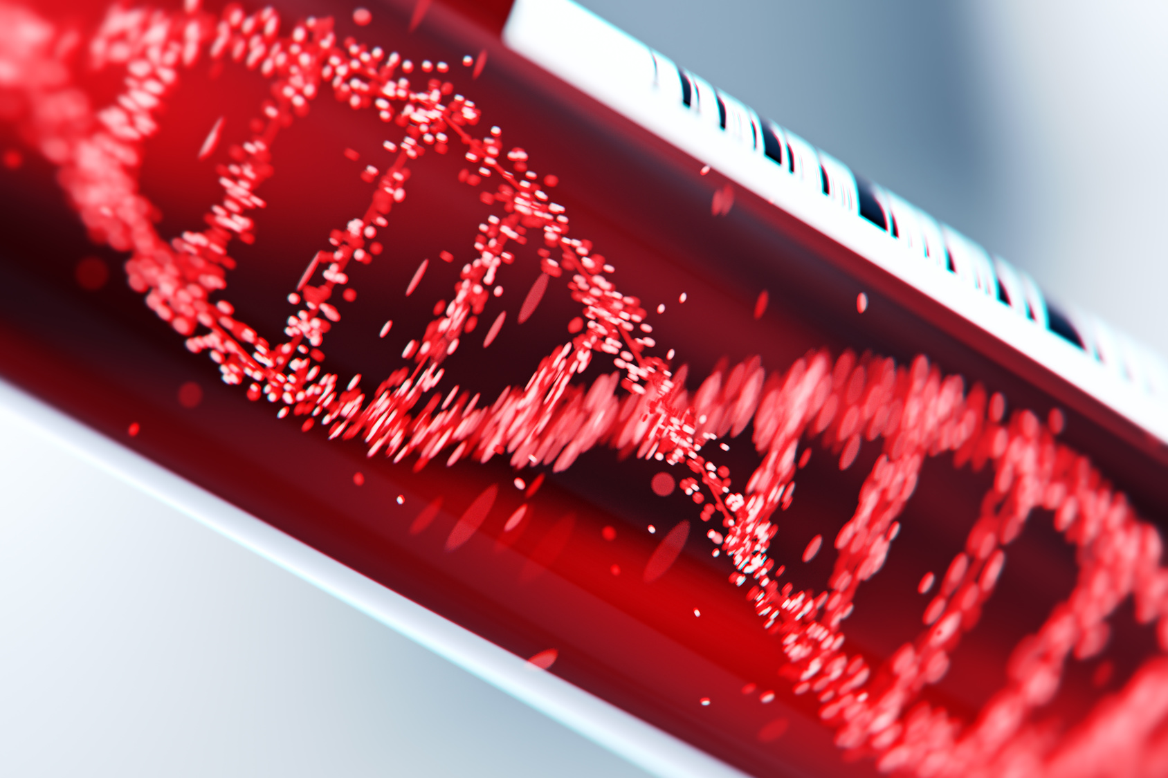 Définition | Hémochromatose